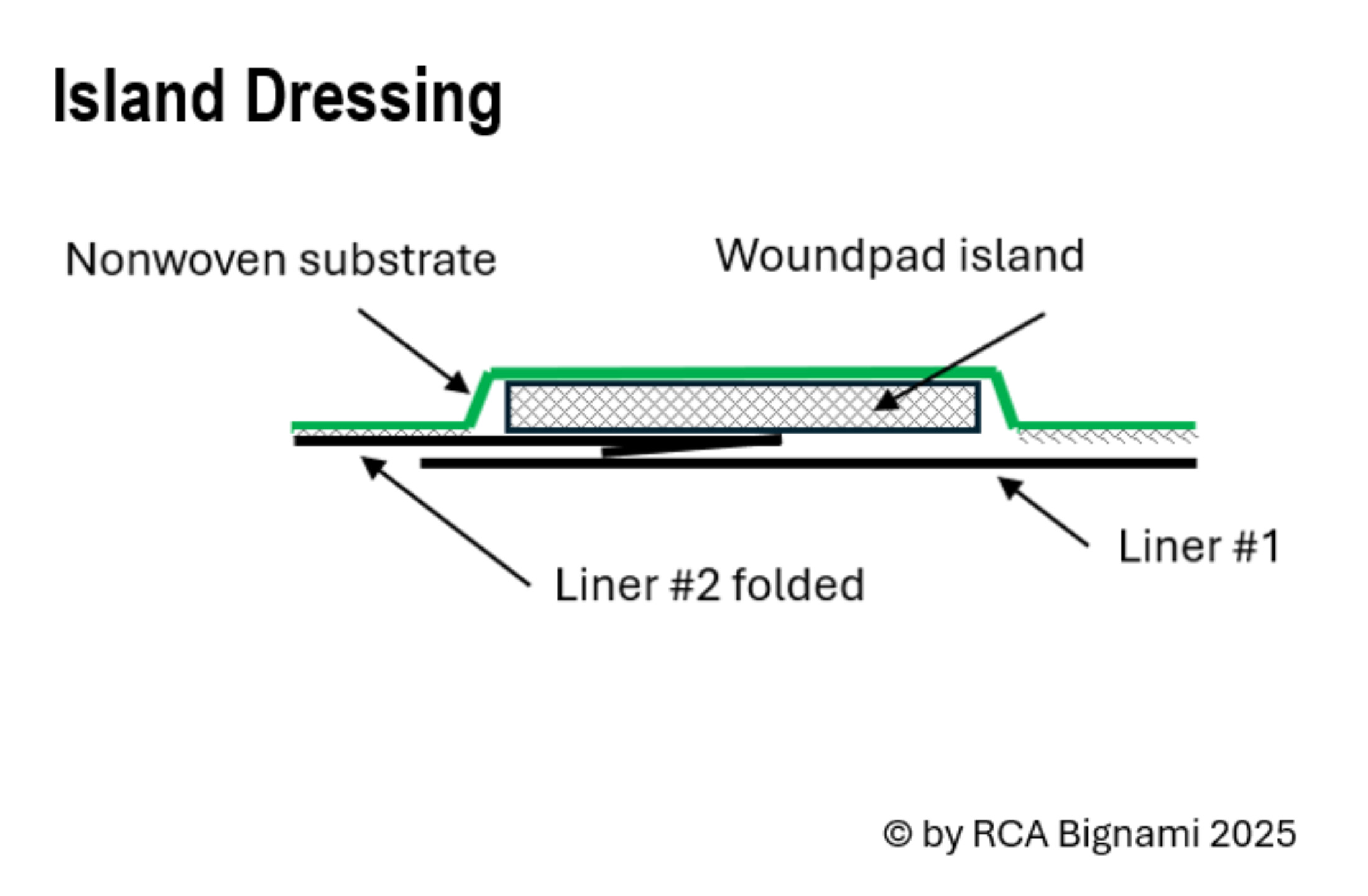 RCA Bignami graphic showing construction of Island Dressing